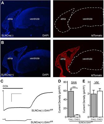 Atrial GIRK Channels Mediate the Effects of Vagus Nerve Stimulation on Heart Rate Dynamics and Arrhythmogenesis